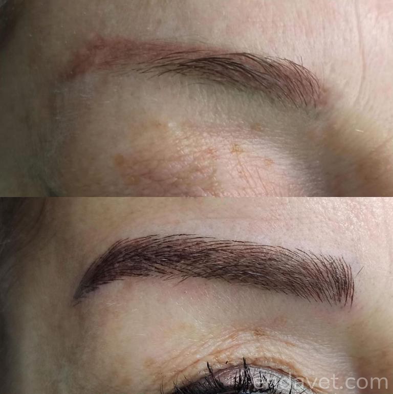 Dr. Derma x Şule Duyan Güzellik